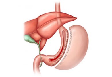 Este estetică inevitabilă după o intervenție chirurgicală la nivelul gurii?